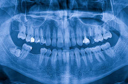 Dental Cone Beam 2B